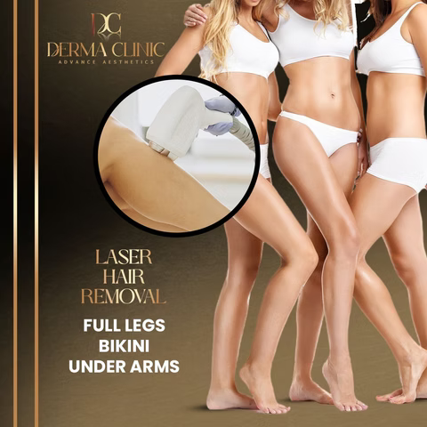 Laser Hair Removal (Soprano)